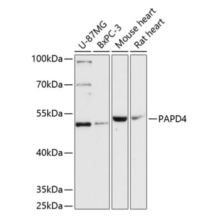 Western Blot - Anti-TENT2 Antibody (A90540) - Antibodies.com