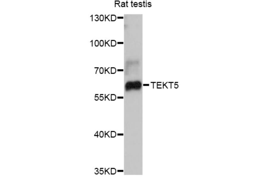 Western Blot - Anti-TEKT5 Antibody (A12377) - Antibodies.com