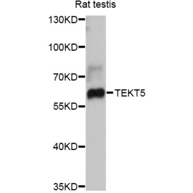 Western Blot - Anti-TEKT5 Antibody (A12377) - Antibodies.com