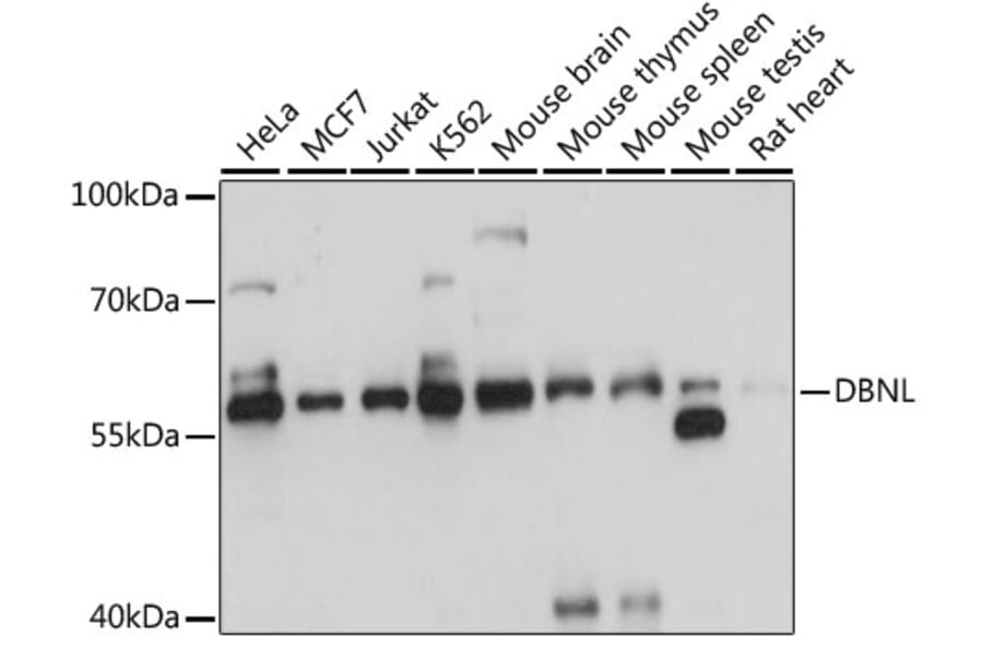 Western Blot - Anti-HIP55 Antibody (A90542) - Antibodies.com