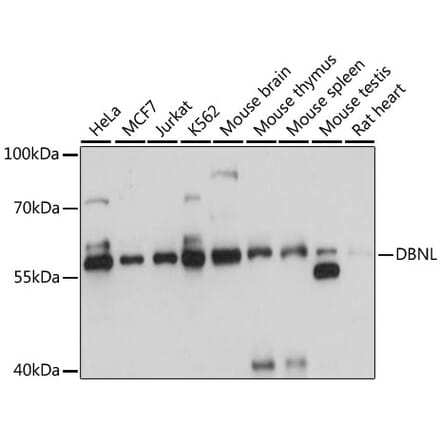 Western Blot - Anti-HIP55 Antibody (A90542) - Antibodies.com