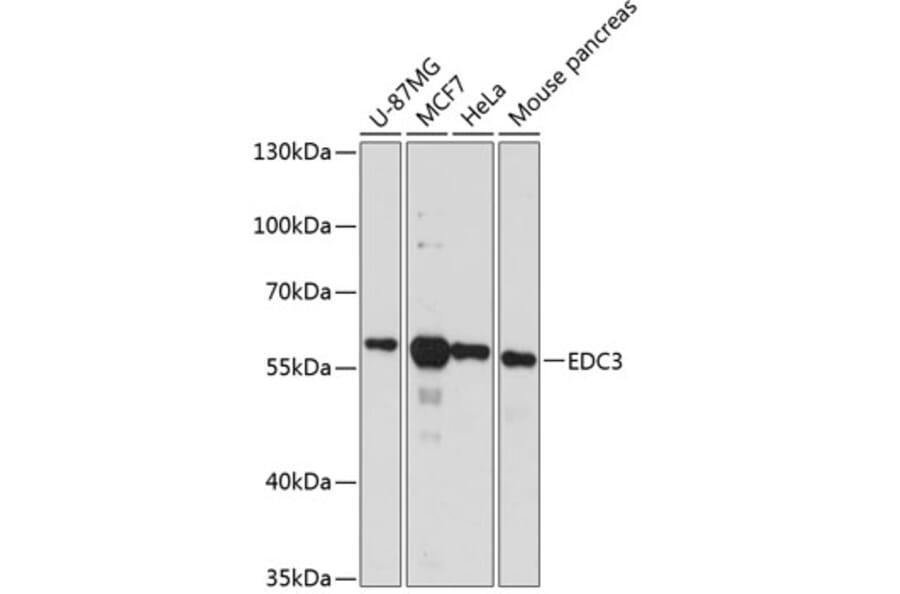 Western Blot - Anti-EDC3 Antibody (A90544) - Antibodies.com