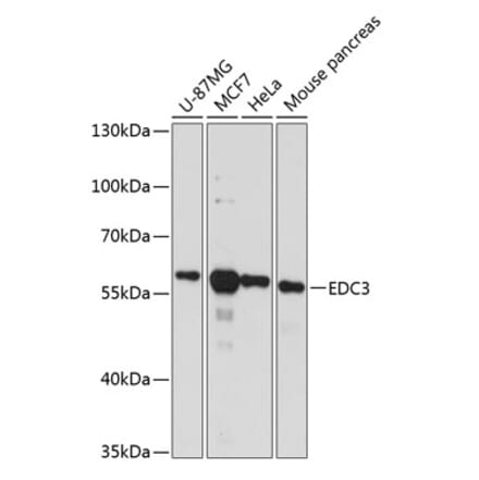 Western Blot - Anti-EDC3 Antibody (A90544) - Antibodies.com