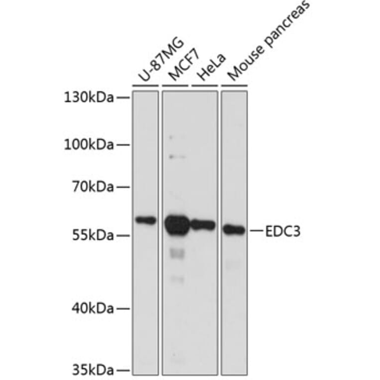 Western Blot - Anti-EDC3 Antibody (A90544) - Antibodies.com