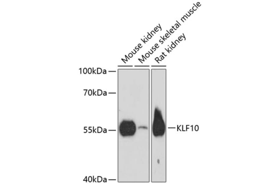 Western Blot - Anti-KLF10 Antibody (A90545) - Antibodies.com