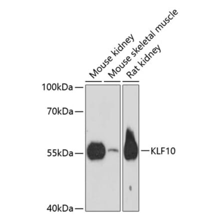 Western Blot - Anti-KLF10 Antibody (A90545) - Antibodies.com