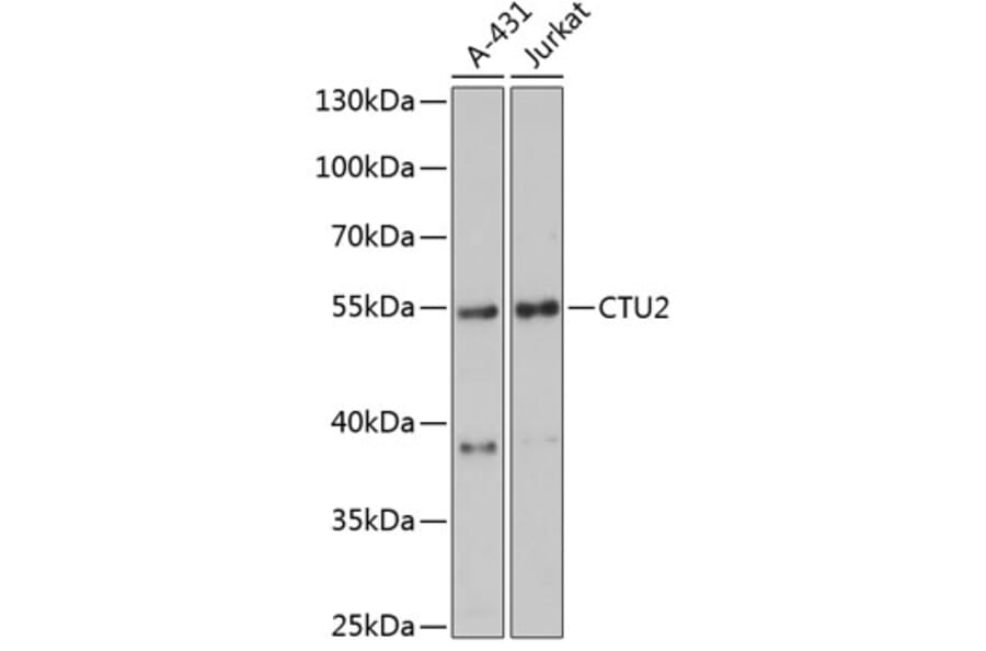 Western Blot - Anti-CTU2/NCS2 Antibody (A90546) - Antibodies.com