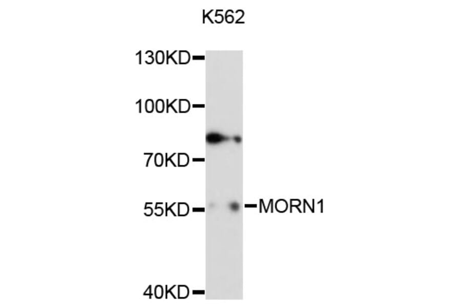 Western Blot - Anti-MORN1 Antibody (A13194) - Antibodies.com