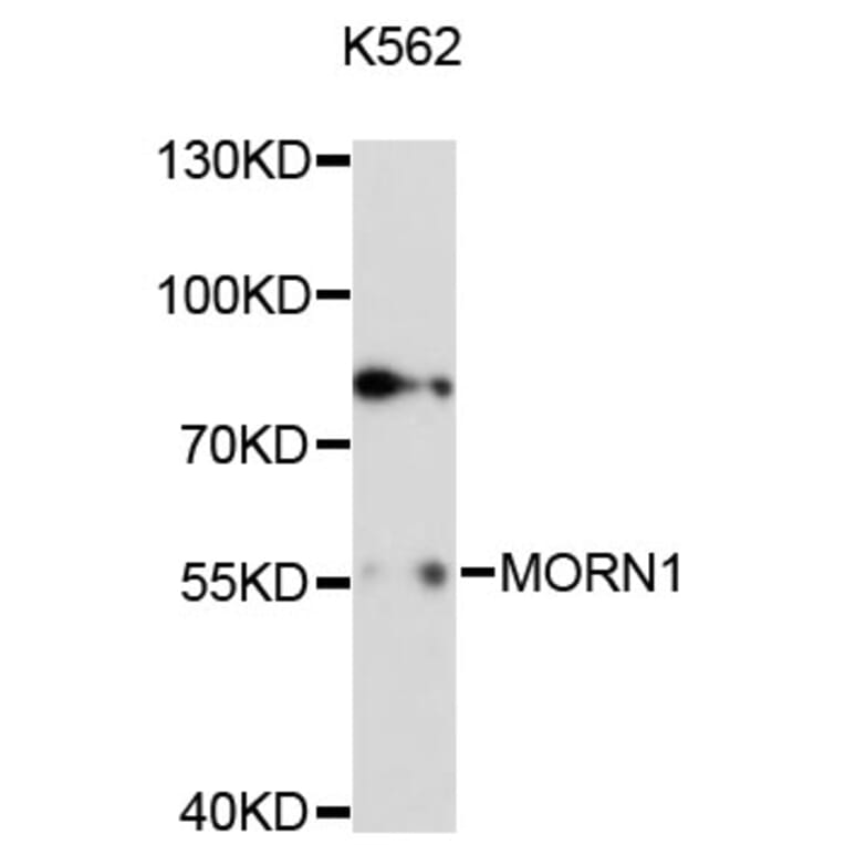 Western Blot - Anti-MORN1 Antibody (A13194) - Antibodies.com