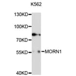 Western Blot - Anti-MORN1 Antibody (A13194) - Antibodies.com