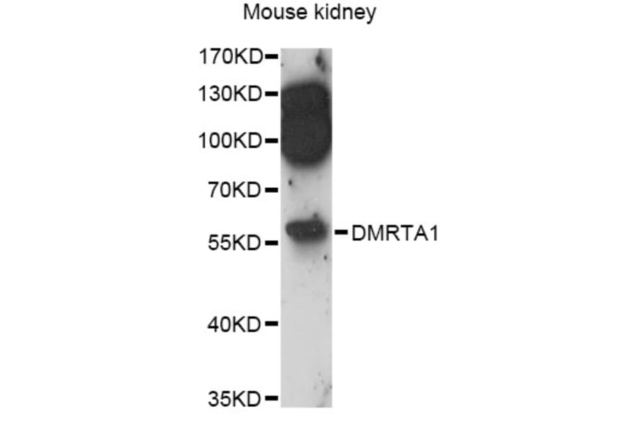 Western Blot - Anti-DMRTA1 Antibody (A14338) - Antibodies.com
