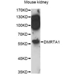 Western Blot - Anti-DMRTA1 Antibody (A14338) - Antibodies.com