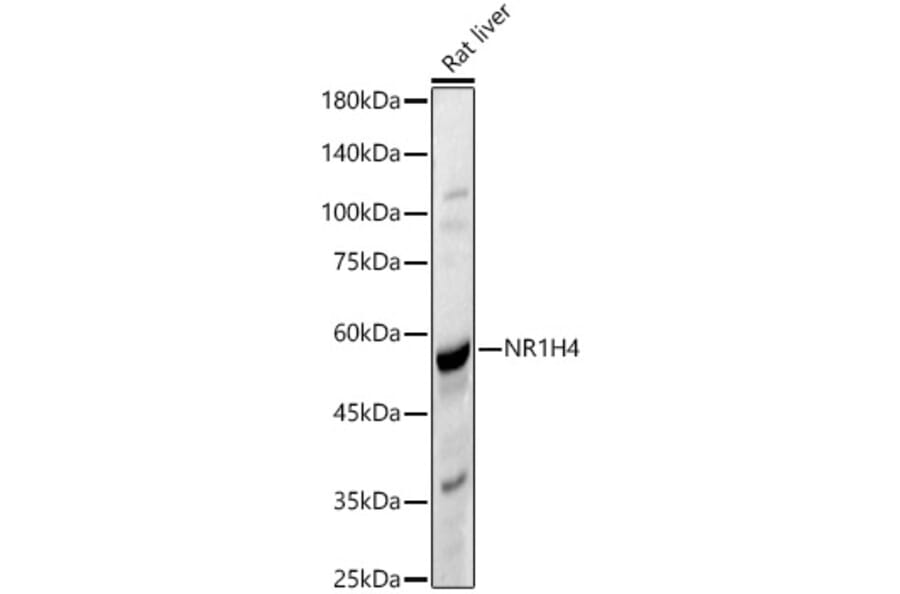 Western Blot - Anti-Bile Acid Receptor NR1H4 Antibody (A90549) - Antibodies.com