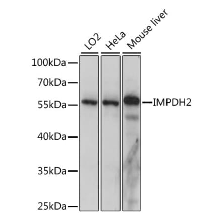 Western Blot - Anti-IMPDH2 Antibody (A90550) - Antibodies.com