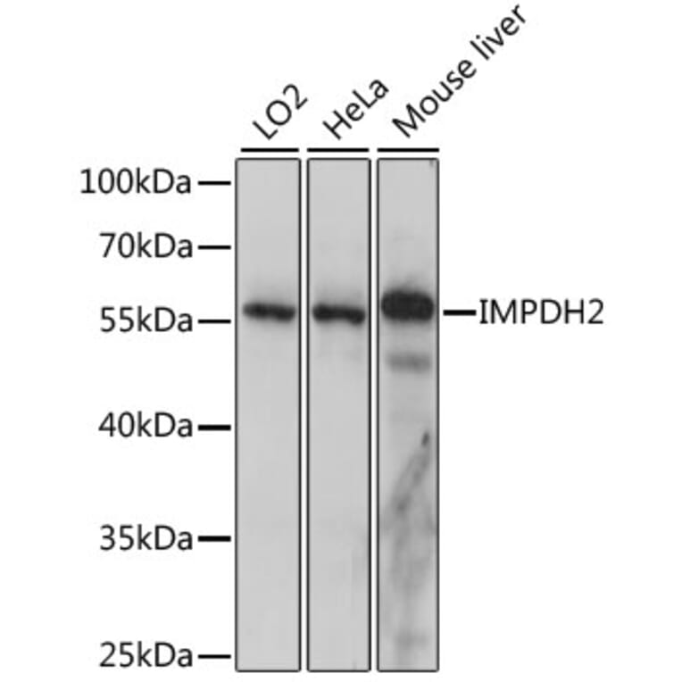 Western Blot - Anti-IMPDH2 Antibody (A90550) - Antibodies.com