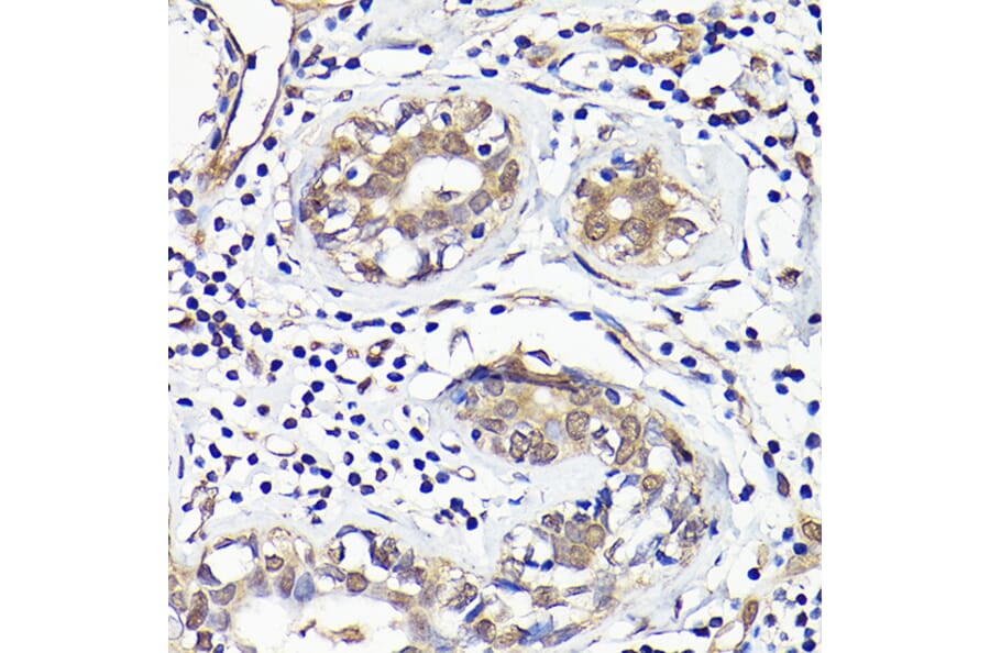 Immunohistochemistry - Anti-IMPDH2 Antibody (A90550) - Antibodies.com