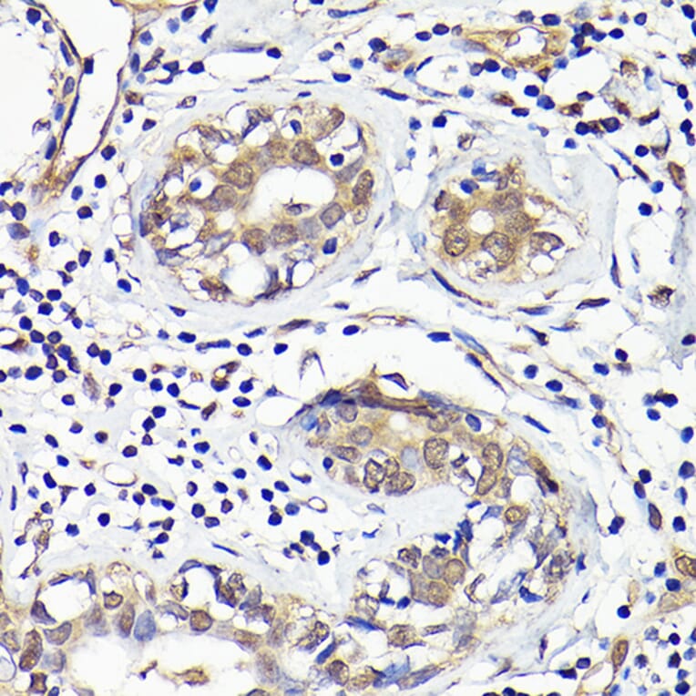 Immunohistochemistry - Anti-IMPDH2 Antibody (A90550) - Antibodies.com