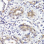 Immunohistochemistry - Anti-IMPDH2 Antibody (A90550) - Antibodies.com