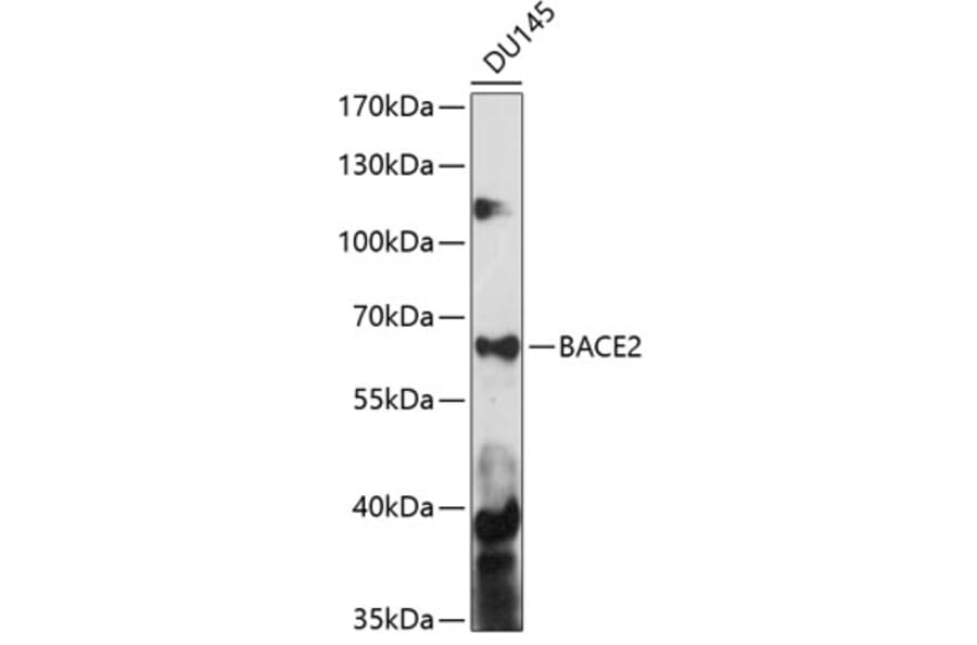 Western Blot - Anti-BACE2 Antibody (A90551) - Antibodies.com