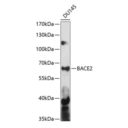 Western Blot - Anti-BACE2 Antibody (A90551) - Antibodies.com