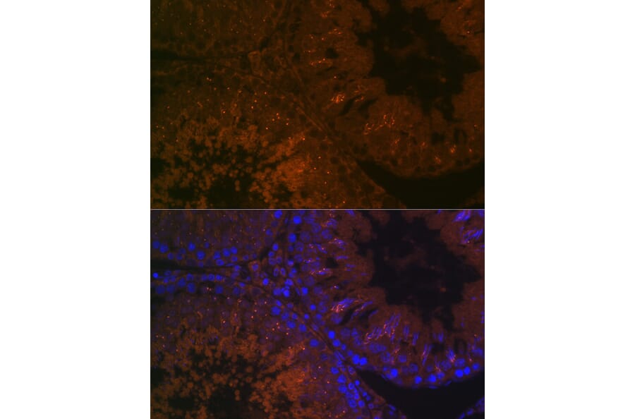 Immunofluorescence - Anti-BACE2 Antibody (A90551) - Antibodies.com
