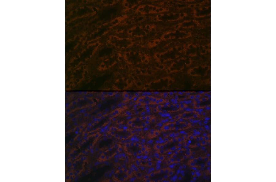 Immunofluorescence - Anti-BACE2 Antibody (A90551) - Antibodies.com