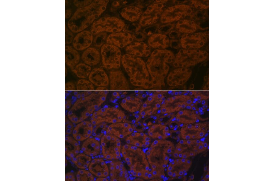 Immunofluorescence - Anti-BACE2 Antibody (A90551) - Antibodies.com
