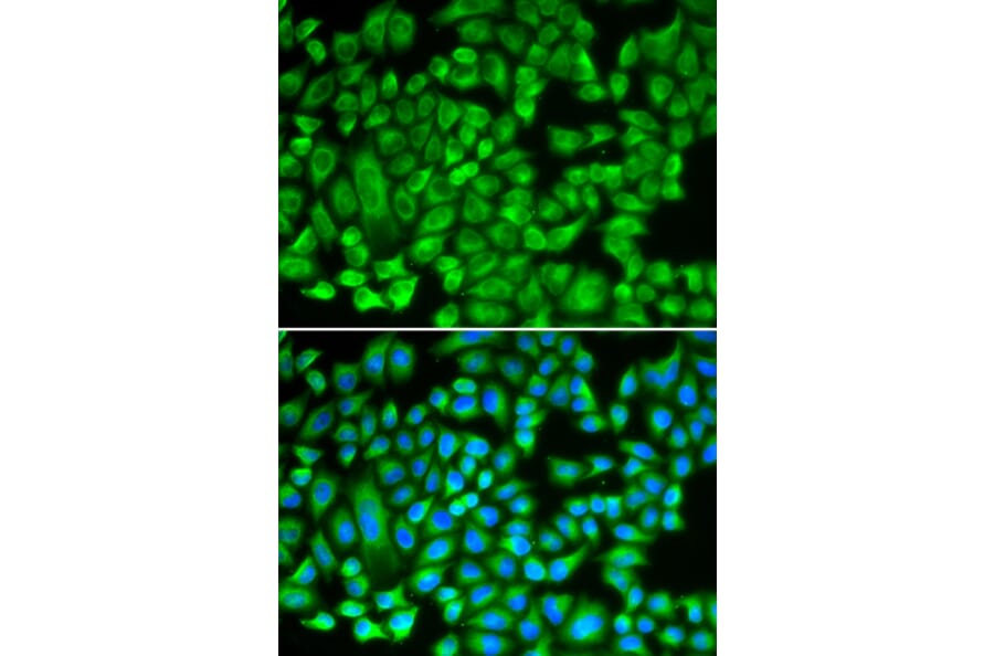 Immunofluorescence - Anti-KAT5 Antibody (A13259) - Antibodies.com