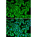 Immunofluorescence - Anti-KAT5 Antibody (A13259) - Antibodies.com