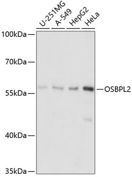 Western blot analysis of extracts of various cell lines, using Anti-OSBPL2 Antibody (A14199) at 1:1,000 dilution.
Secondary antibody: Goat Anti-Rabbit IgG (H+L) (HRP) (AS014) at 1:10,000 dilution.
Lysates / proteins: 25µg per lane.
Blocking buffer: 3% non-fat dry milk in TBST.
Detection: ECL Basic Kit (RM00020).
Exposure time: 5s.