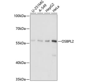 Western Blot - Anti-ORP2 Antibody (A90553) - Antibodies.com