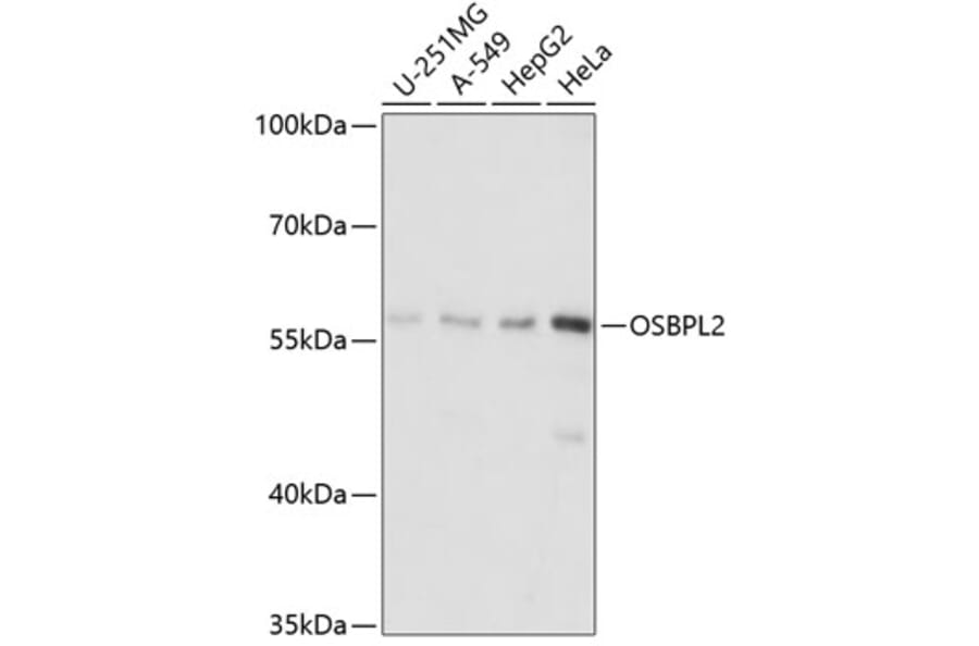 Western Blot - Anti-ORP2 Antibody (A90553) - Antibodies.com