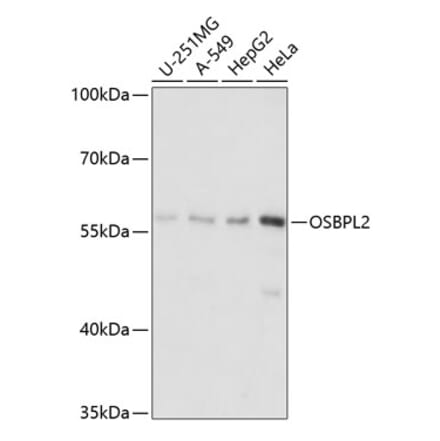 Western Blot - Anti-ORP2 Antibody (A90553) - Antibodies.com