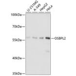 Western Blot - Anti-ORP2 Antibody (A90553) - Antibodies.com