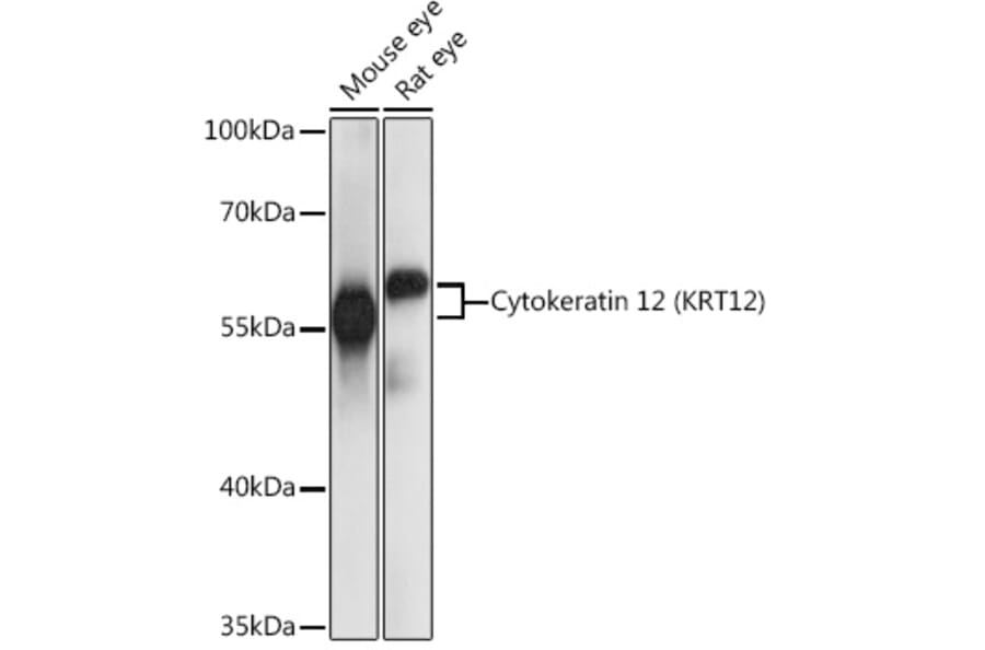 Western Blot - Anti-Keratin 12/K12 Antibody (A90554) - Antibodies.com
