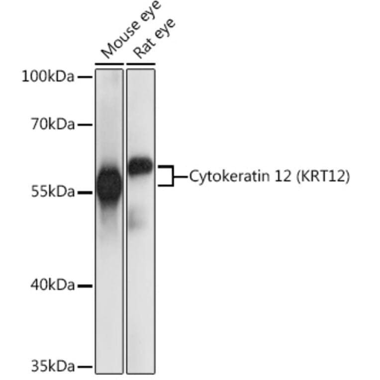 Western Blot - Anti-Keratin 12/K12 Antibody (A90554) - Antibodies.com