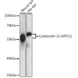 Western Blot - Anti-Keratin 12/K12 Antibody (A90554) - Antibodies.com