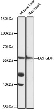 Western blot analysis of extracts of various cell lines, using Anti-D2HGDH Antibody (A16213) at 1:1,000 dilution.
Secondary antibody: Goat Anti-Rabbit IgG (H+L) (HRP) (AS014) at 1:10,000 dilution.
Lysates / proteins: 25µg per lane.
Blocking buffer: 3% non-fat dry milk in TBST.
Detection: ECL Basic Kit (RM00020).
Exposure time: 90s.