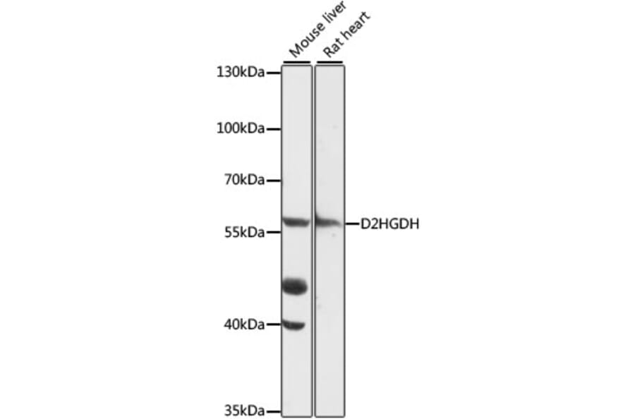 Western Blot - Anti-D2HGDH Antibody (A90556) - Antibodies.com