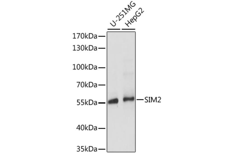 Western Blot - Anti-SIM2 Antibody (A90557) - Antibodies.com
