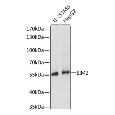 Western Blot - Anti-SIM2 Antibody (A90557) - Antibodies.com