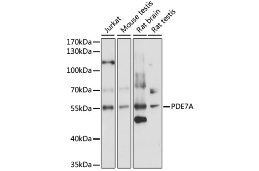 Western Blot - Anti-PDE7A/HCP1 Antibody (A90558) - Antibodies.com