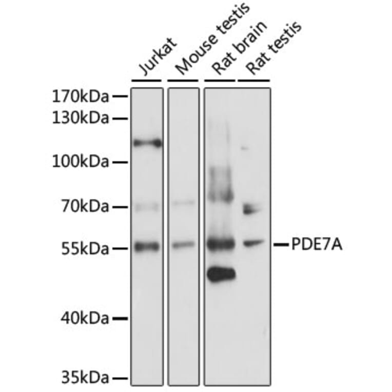 Western Blot - Anti-PDE7A/HCP1 Antibody (A90558) - Antibodies.com