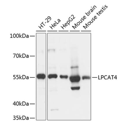 Western Blot - Anti-AGPAT7 Antibody (A90559) - Antibodies.com