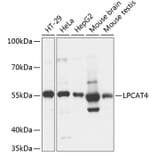 Western Blot - Anti-AGPAT7 Antibody (A90559) - Antibodies.com