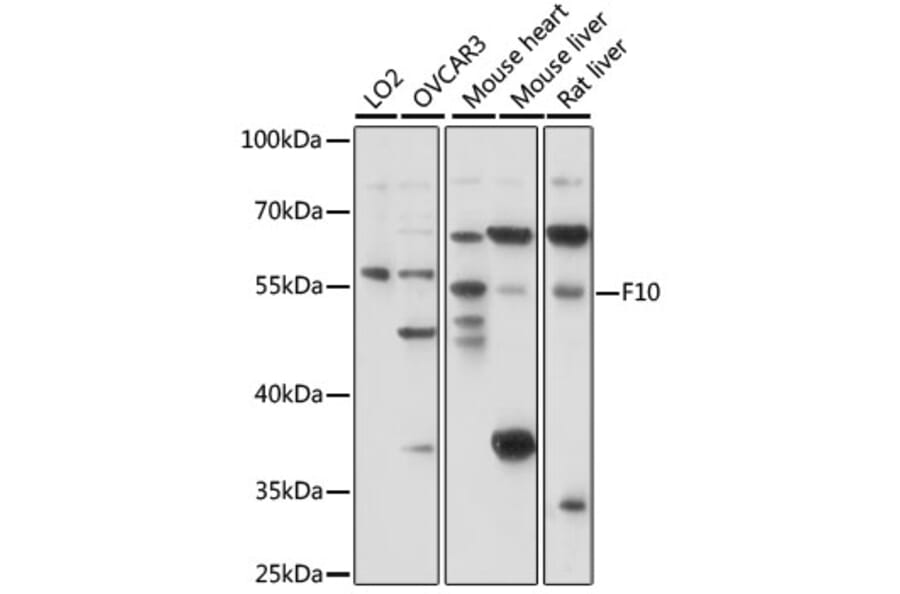 Western Blot - Anti-Factor X Antibody (A90560) - Antibodies.com