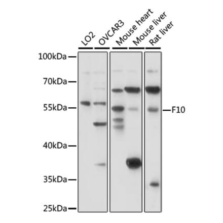 Western Blot - Anti-Factor X Antibody (A90560) - Antibodies.com
