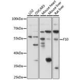 Western Blot - Anti-Factor X Antibody (A90560) - Antibodies.com