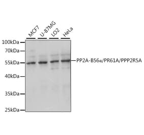Western Blot - Anti-PPP2R5A Antibody (A90561) - Antibodies.com
