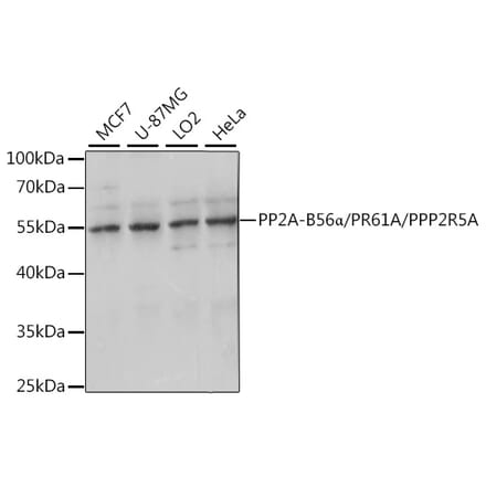 Western Blot - Anti-PPP2R5A Antibody (A90561) - Antibodies.com